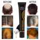 Organic Hair Regrowth Serum Roller – Anti-Hair Loss