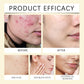 Turmeric Kojic Acid Face Cleanser