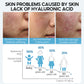 Hyaluronic Acid Face Serum – Anti-Aging & Moisturizing